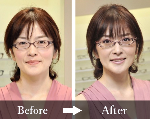 ビフォー・アフター1